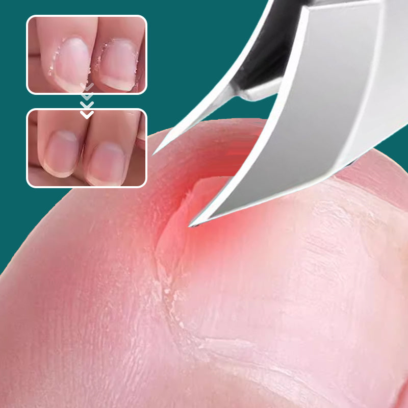 💅Anti-Splash 25° Slant Edge Nail Clipper 3-Piece Set