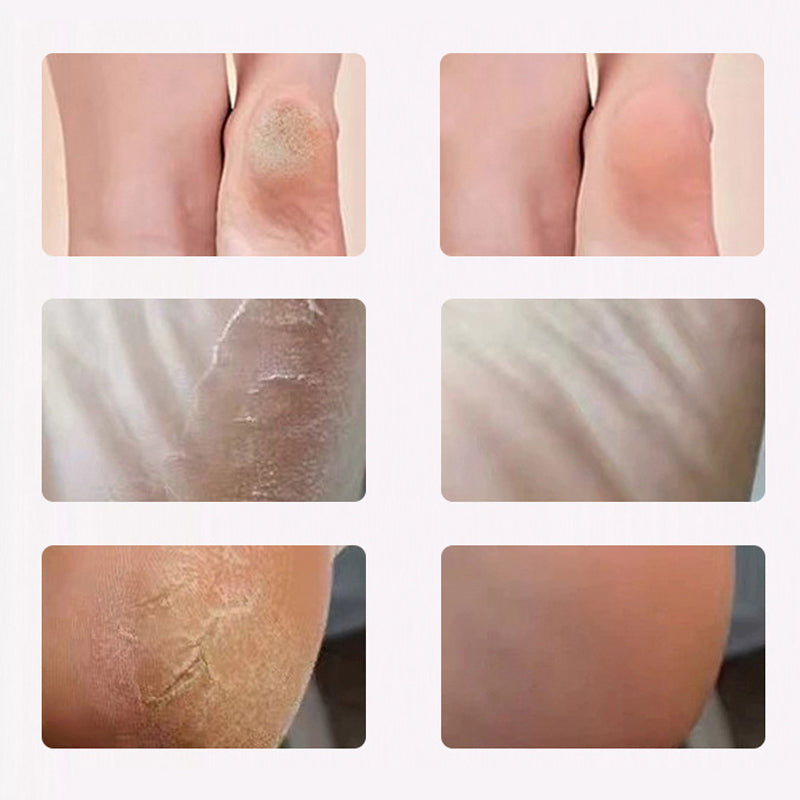 ⏳Time-limited Special🦶Electric Foot Scrubber for Smooth Healthy Skin