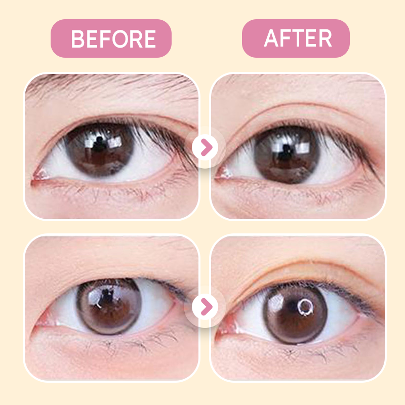 ✨Buy 1 Get 1 Free✨Invisible Strong Support Double Eyelid Tapes