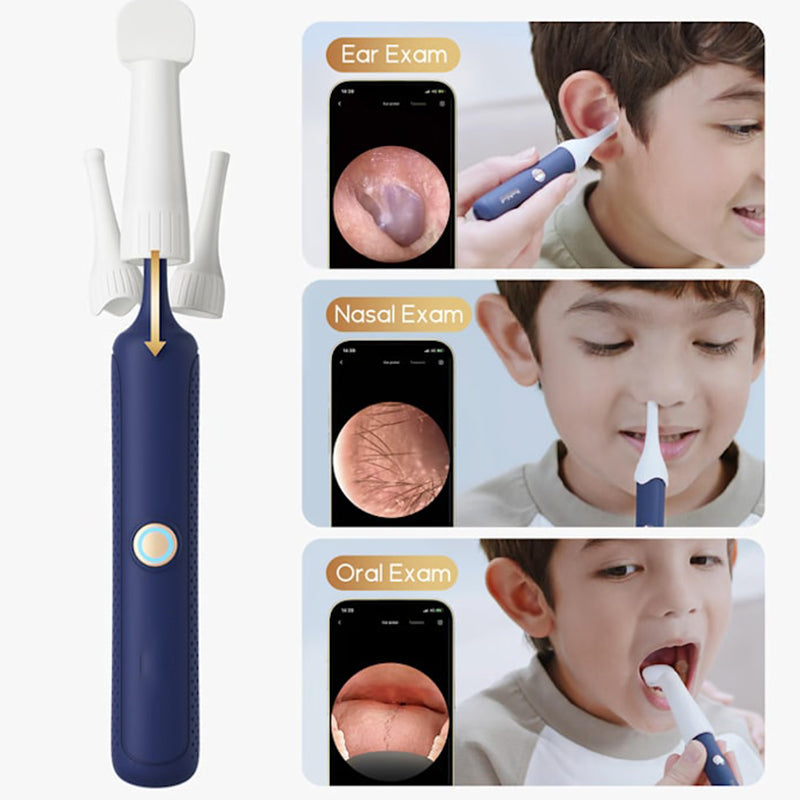 ⏳Time-limited Special⌛ Visual Curved Earwax Removal Kit