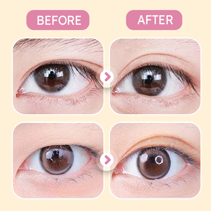 ✨Buy 1 Get 1 Free✨Invisible Strong Support Double Eyelid Tapes